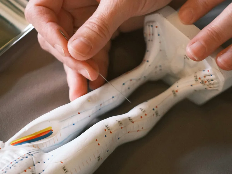 Acupuncture at Active Release TX in Heath