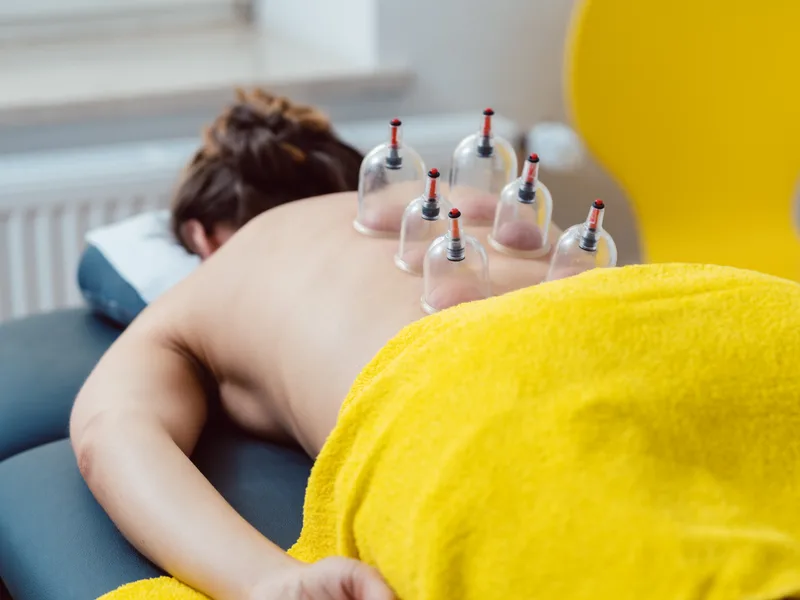 Cupping Therapy at Active Release TX in Heath