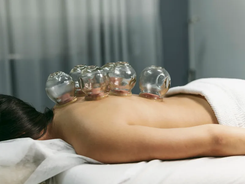 Cupping Therapy at Active Release TX in Heath