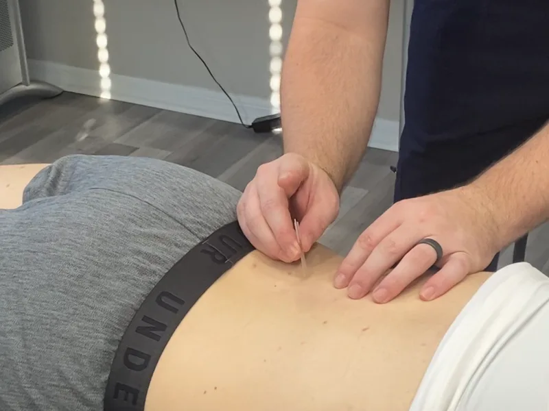 How Dry Needling works at Active Release TX