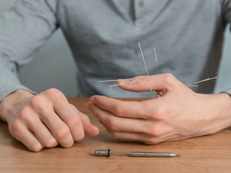 Dry Needling at Active Release TX in Heath
