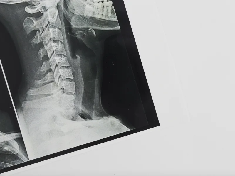 X-Rays at Active Release TX in Heath